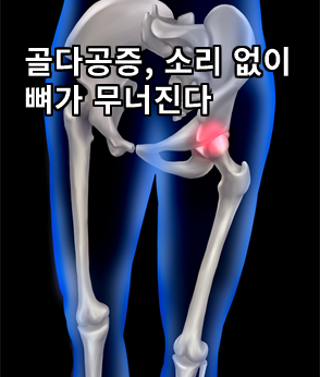 더보기